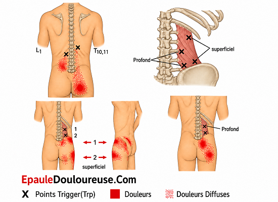 lower back pain?