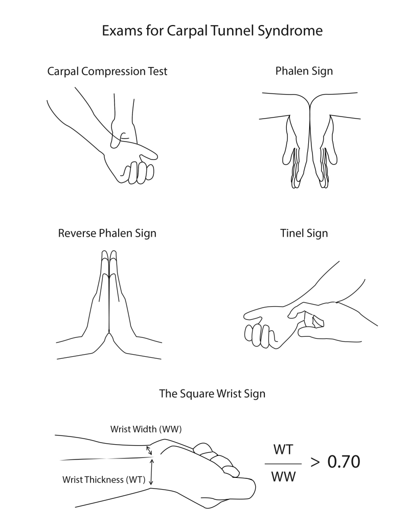engourdissements des mains