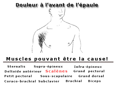 Douleur en avant de l'épaule