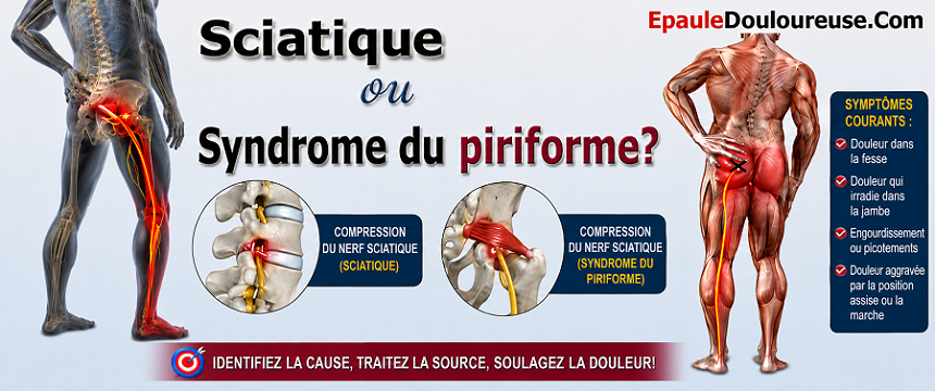 mal dans la fesse