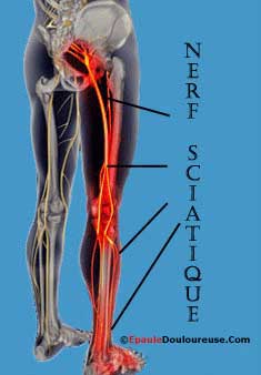 hip myofascial release